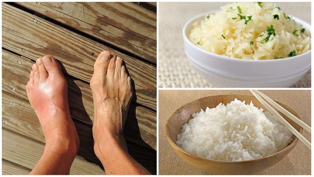 A rice-based diet is recommended for arthritis patients. 